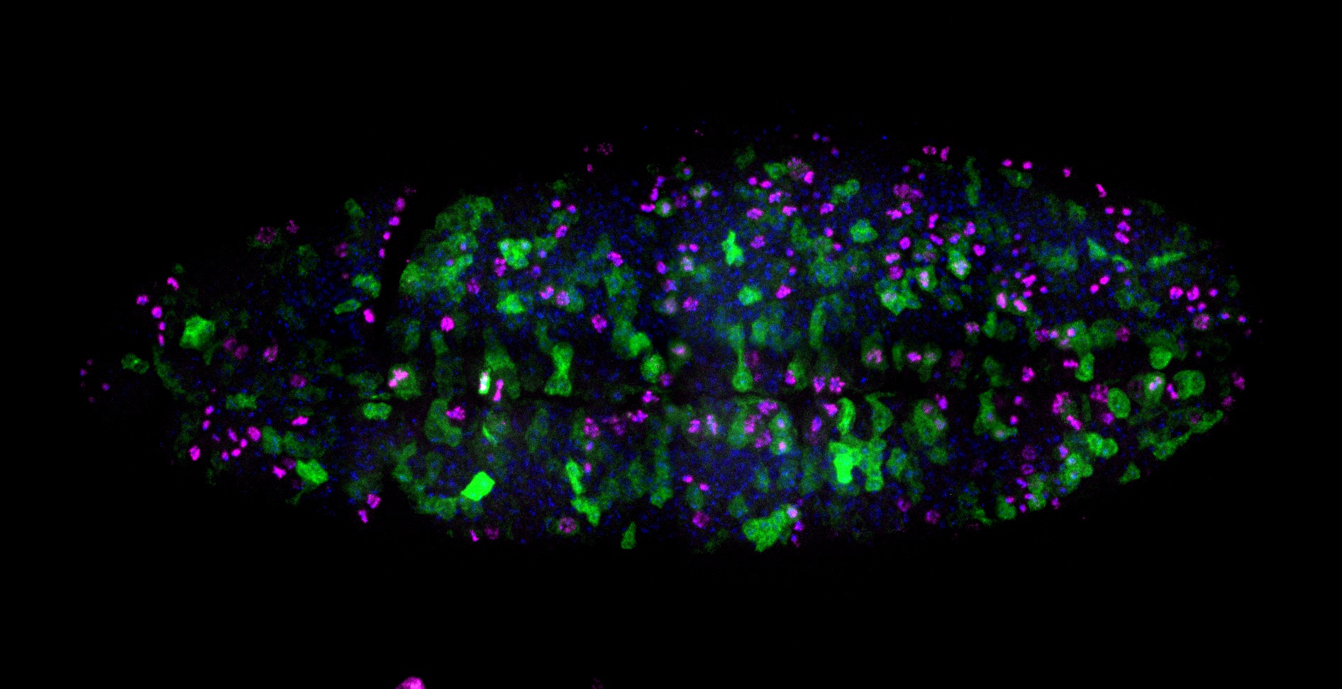 2-dimensional fluorescent image of a wound in the epidermis of a fruit fly embryo