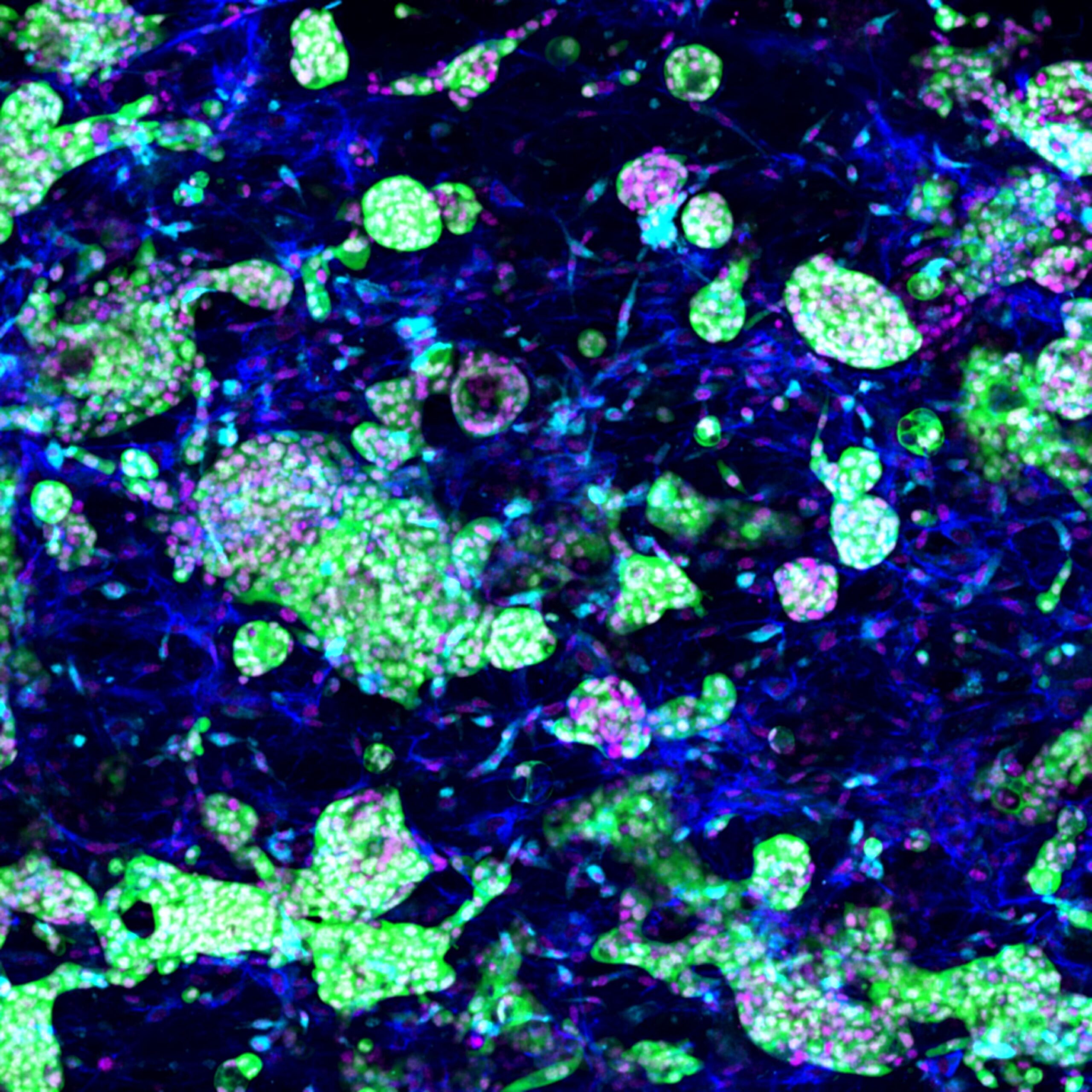 With reference to the painting by Claude Monet, the cell pond represents a 3D in vitro niche of the tumour-stromal interface in pancreatic cancer. The niche consists of patient-derived pancreatic cancer organoids (green), cancer-associated fibroblasts (blue), and tumour-associated macrophages (cyan). Cell nuclei are captured in pink.