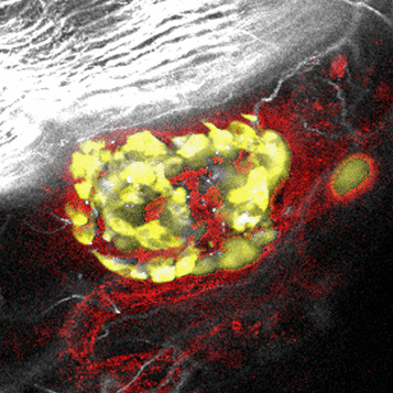 Transplanted-islet-featured-image